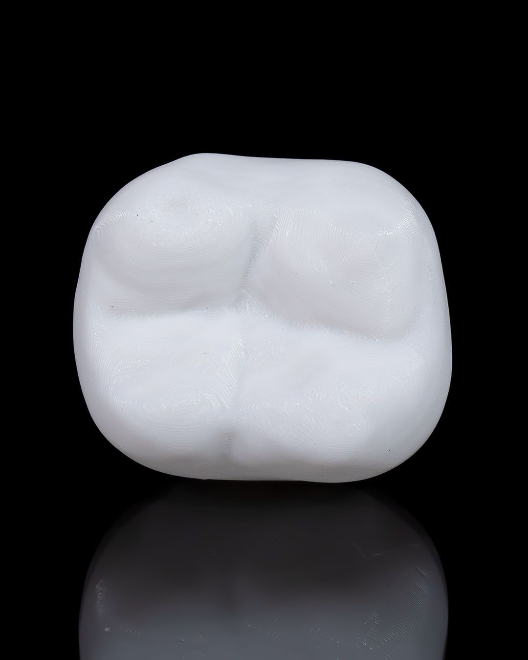 Implant Dentar