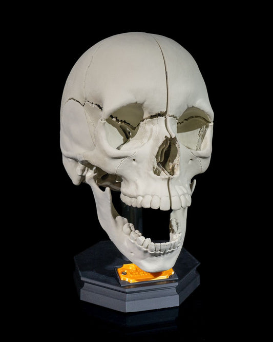 Craniul