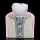 Implant Dentar