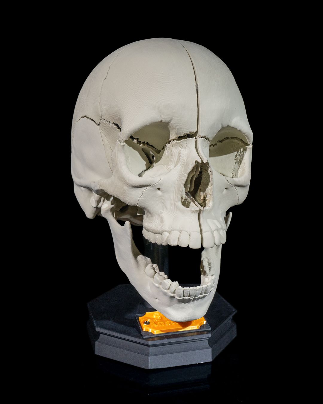 Craniul