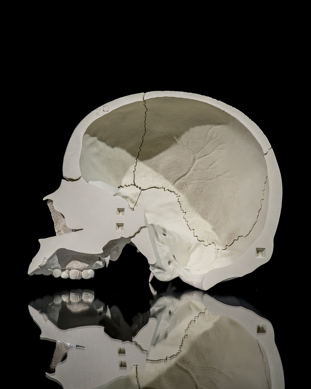 Craniul