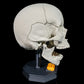 Craniul