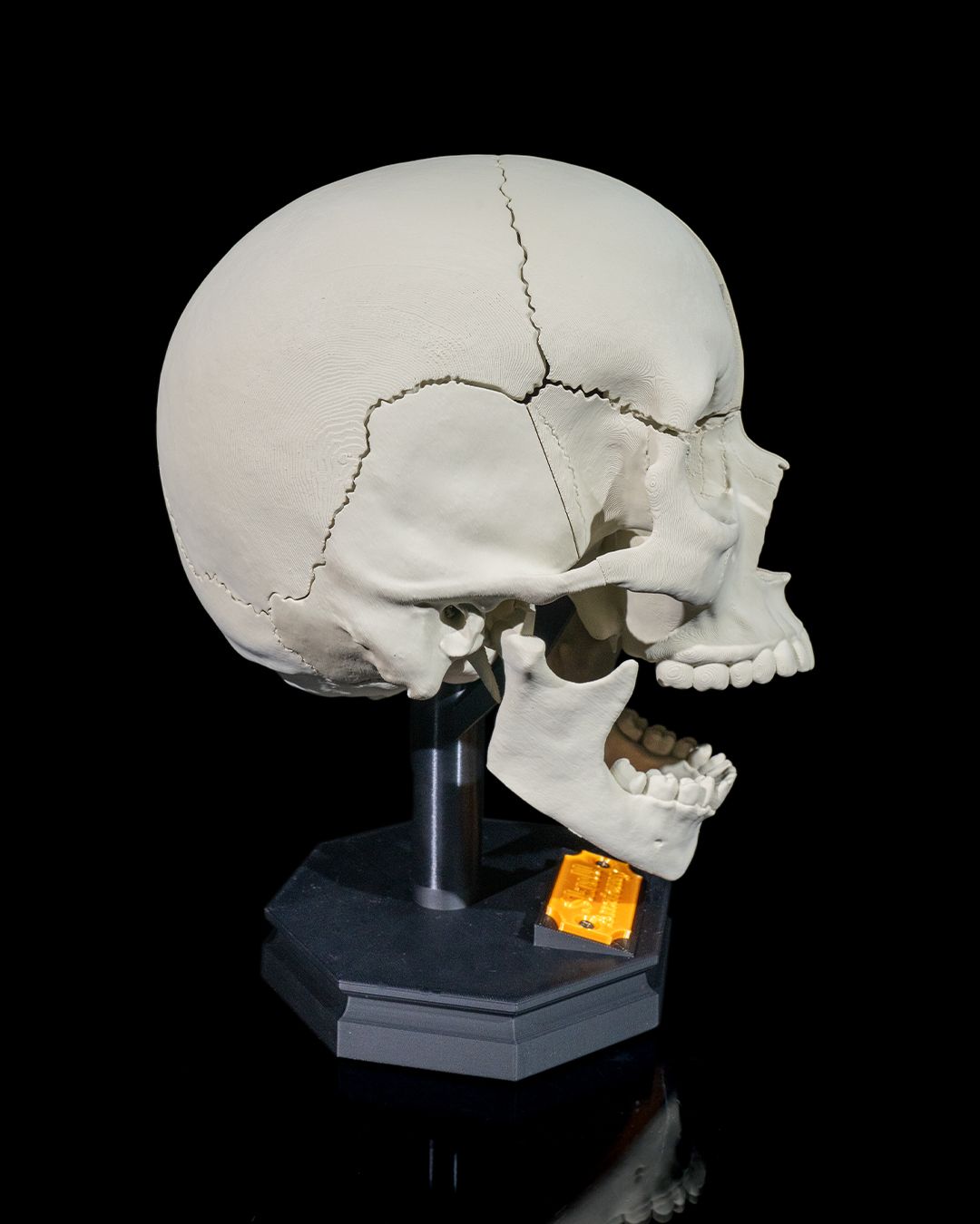Craniul