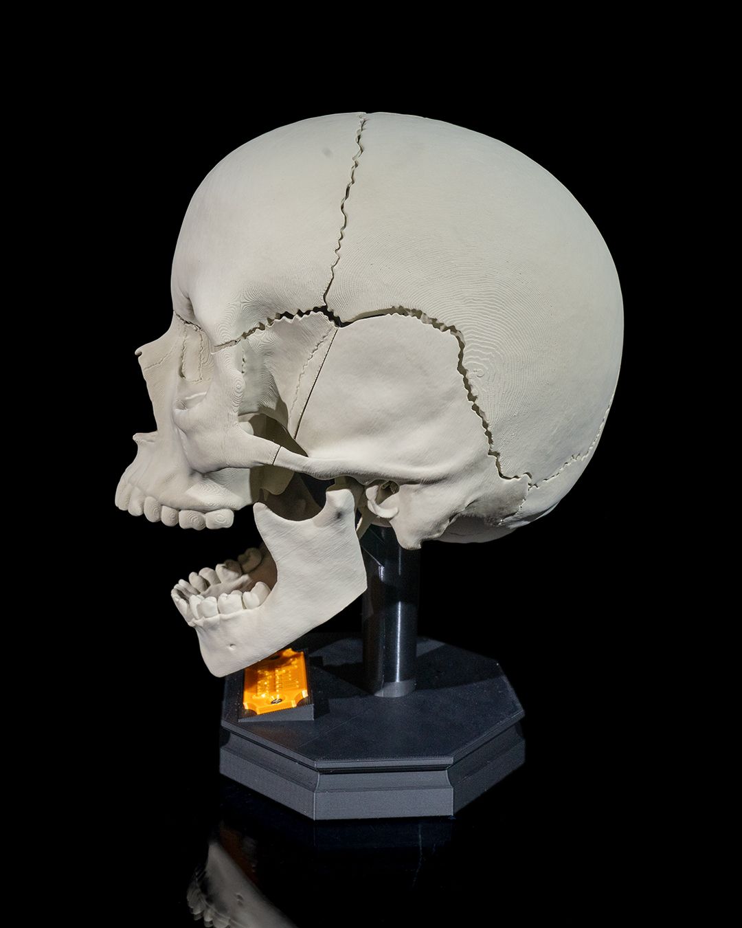 Craniul